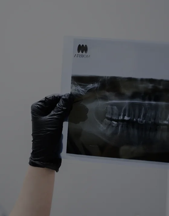 An ELITES doctor studying a panoramic image of a patient's jaw