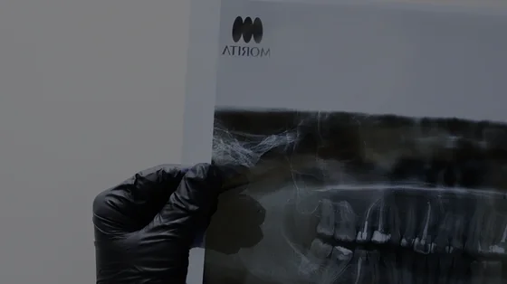 An ELITES doctor holding a panoramic image of a patient's jaw